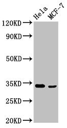 NFKBID Polyclonal Antibody