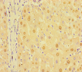 RIT1 Polyclonal Antibody