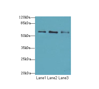 GPR101 Polyclonal Antibody