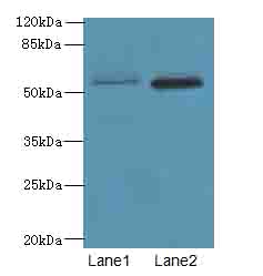 VWA9 Polyclonal Antibody