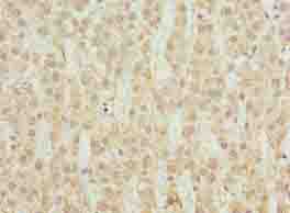 CYP4X1 Polyclonal Antibody