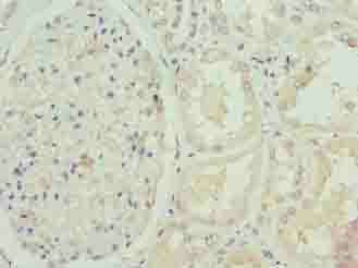 FBXO25 Polyclonal Antibody (20 µl)