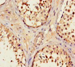 Immunohistochemistry of paraffin-embedded human  testis tissue using GPX8 Polyclonal Antibody at dilution 1:100