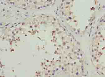 PPP1R14A Polyclonal Antibody