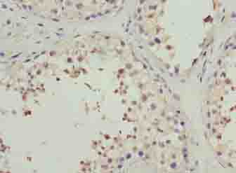 PPP1R14A Polyclonal Antibody
