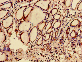 C12orf43 Polyclonal Antibody