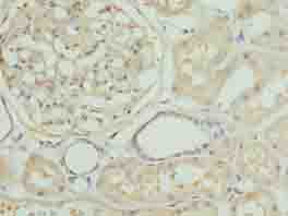 ZNF274 Polyclonal Antibody