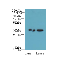 RPRD1A Polyclonal Antibody