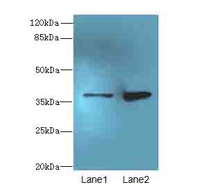 CLYBL Polyclonal Antibody