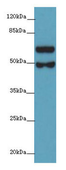 GALNT16 Polyclonal Antibody