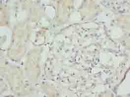 NFAM1 Polyclonal Antibody