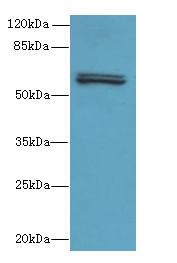 FAM222B Polyclonal Antibody