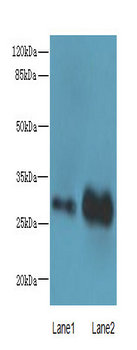 EXOSC8 Polyclonal Antibody