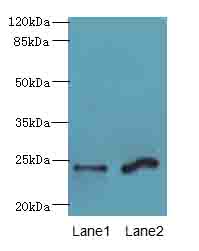 MRAP2 Polyclonal Antibody