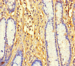 LTV1 Polyclonal Antibody