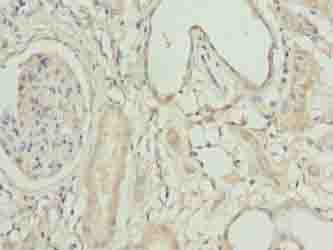 Immunohistochemistry of paraffin-embedded human kidney tissue using ACSBG1 Polyclonal Antibody at dilution of 1:100
