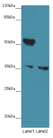 MAGEB10 Polyclonal Antibody