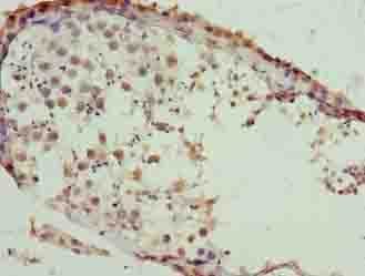 SLC26A8 Polyclonal Antibody