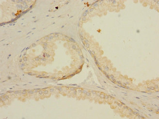 LNX2 Polyclonal Antibody