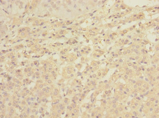 C1orf127 Polyclonal Antibody