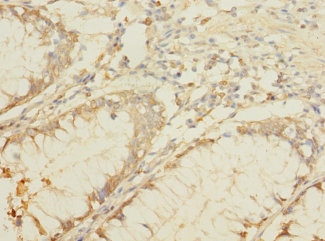 B4GALNT2 Polyclonal Antibody