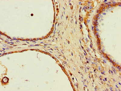 SPPL2A Polyclonal Antibody