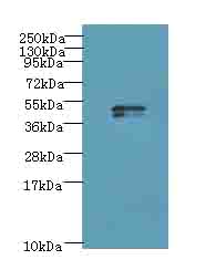 KRT35 Polyclonal Antibody