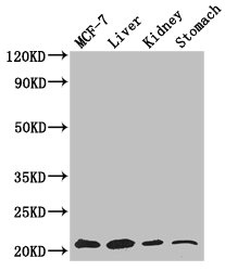 GNPNAT1 Polyclonal Antibody
