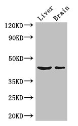 METTL2A Polyclonal Antibody