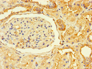 GPR82 Polyclonal Antibody