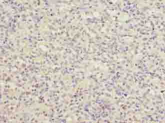 LRRC3B Polyclonal Antibody (100 µl)