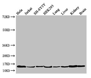 PAIP2 Polyclonal Antibody