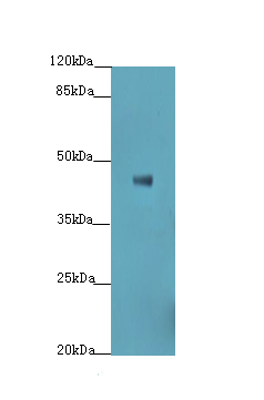 S1PR3 Polyclonal Antibody
