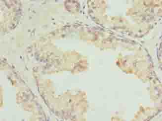 GPR21 Polyclonal Antibody