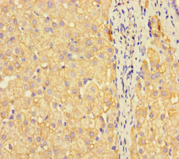 METTL7A Polyclonal Antibody (100 µl)