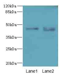 KCNK13 Polyclonal Antibody