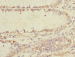 BEX1 Polyclonal Antibody (100 µl)