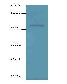 PLXNA4 Polyclonal Antibody