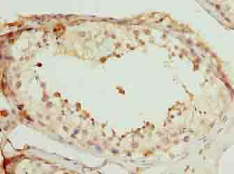 SCAPER Polyclonal Antibody