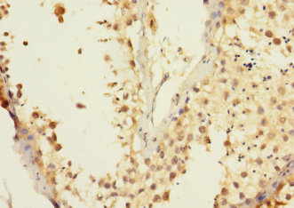 Immunohistochemistry of paraffin-embedded human testis tissue ADAM7 Polyclonal Antibody at dilution 1:100