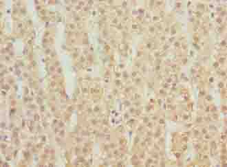 MFSD1 Polyclonal Antibody