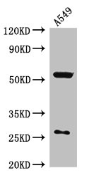 NARFL Polyclonal Antibody