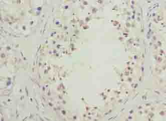 SPACA1 Polyclonal Antibody