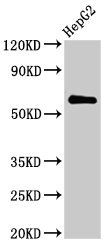 CTPS2 Polyclonal Antibody