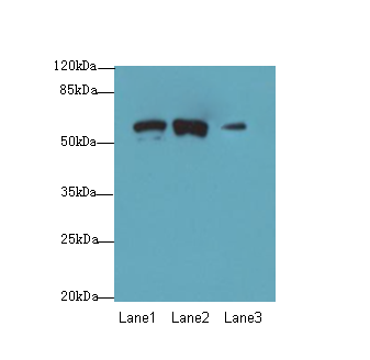 SPTLC3 Polyclonal Antibody
