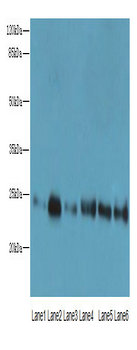 FKBP14 Polyclonal Antibody