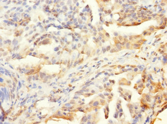 HCFC1R1 Polyclonal Antibody