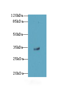 OSER1 Polyclonal Antibody