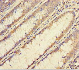 FBXL17 Polyclonal Antibody (50 µl)