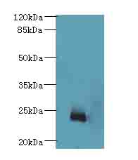 NICN1 Polyclonal Antibody